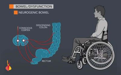 Bowel Management