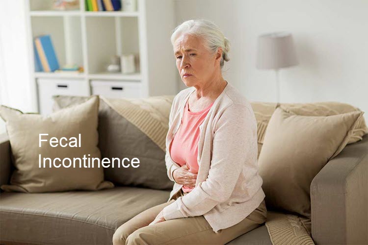 Fecal Incontinence