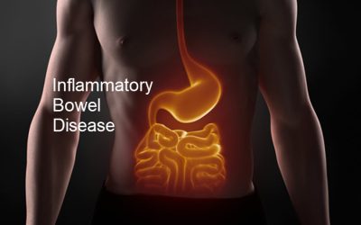 Inflammatory Bowel Disease (IBD)