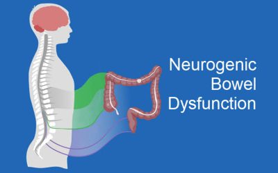 Neurogenic Bowel Dysfunction